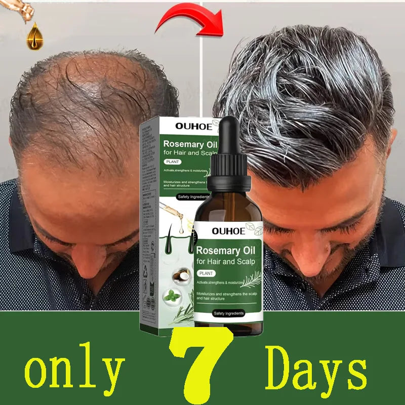 RegrowX™ Rosemary & Mint Hair Growth Oil – Anti-Hair Loss & Root Strengthening Treatment (50ml)
