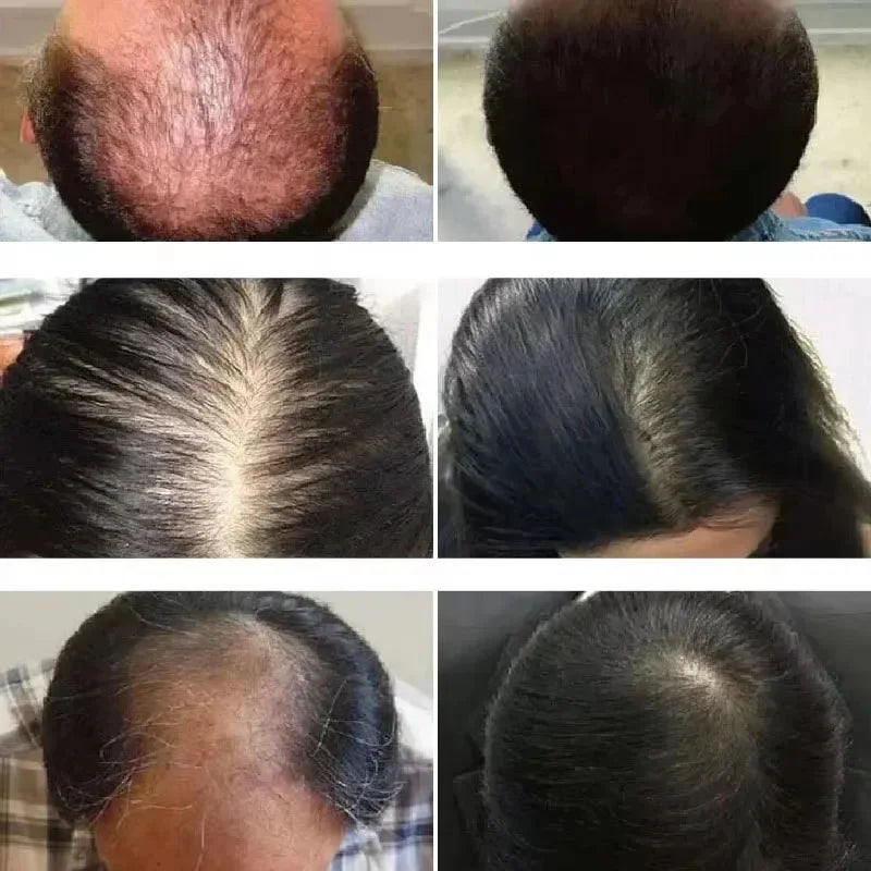 RegrowX™ Rosemary & Mint Hair Growth Oil – Anti-Hair Loss & Root Strengthening Treatment (50ml)